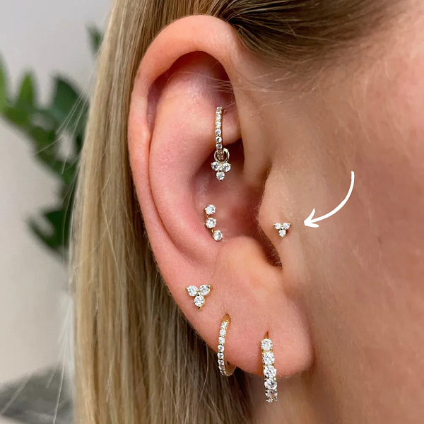 Bấm lỗ tai tại điểm Tragus và Anti-tragus